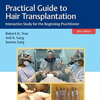 Practical Guide to Hair Transplantation – Interactive Study for the Beginning Practitioner